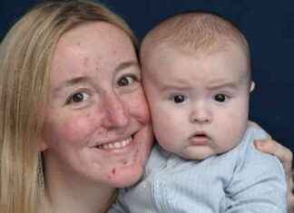 Midwives amazed by mother delivering largest baby ever born news-14102024-014307