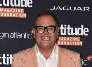 Alan Carr’s Terrifying Health Scare and Procedure Experience alan-carrs-terrifying-health-scare-and-procedure-experience